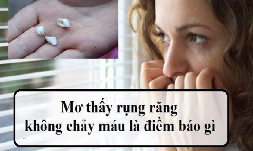 Giải Mã Nằm Mơ Thấy Rụng Răng Không Chảy Máu Đánh Số Mấy? nam-mo-thay-rung-rang-khong-chay-mau-danh-so-may